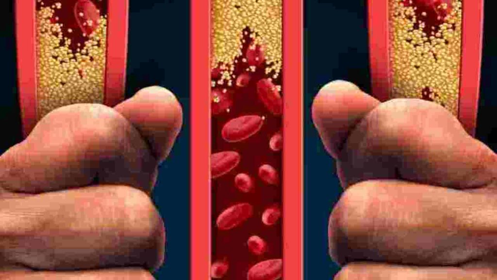 que dieta seguir para bajar colesterol 1