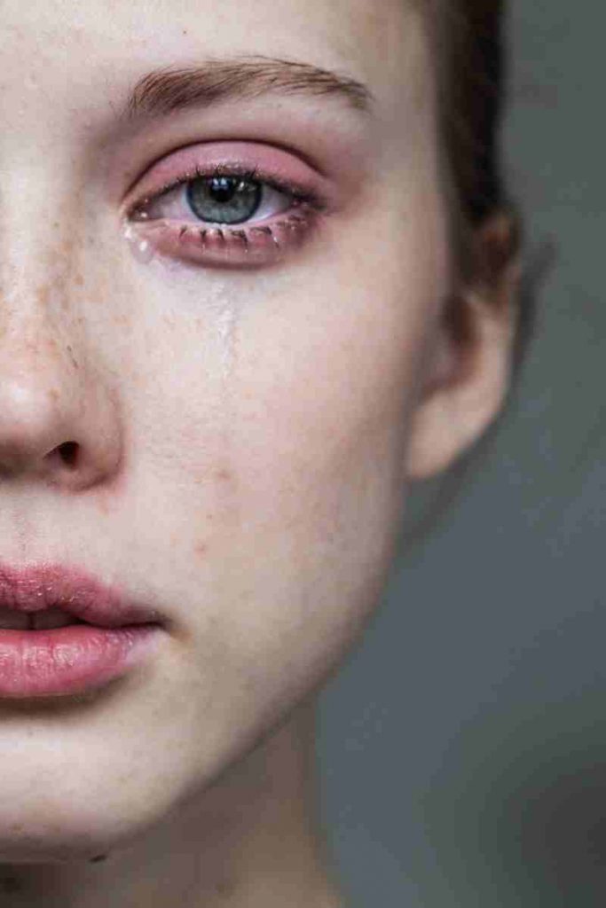 Hipotiroidismo, depresión y obesidad ¿mito o realidad? 5 hipotiroidismo depresión cansancio 1