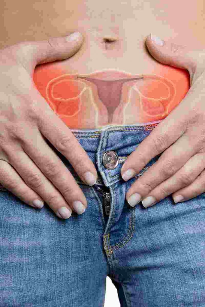 dieta para ovario poliquístico SOP 1