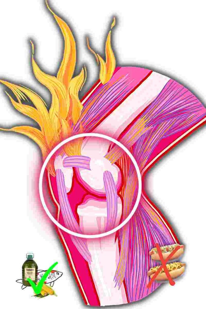 alimentacion para la artritis reumatoide 1