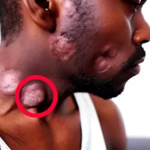 dieta-sin-histamina 1